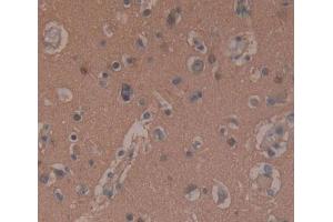 #VALUE! (SNAP25 antibody)