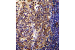 His6-DEP-1 Antibody (ABIN655037 and ABIN2844669) immunohistochemistry analysis in formalin fixed and paraffin embedded human tonsil tissue followed by peroxidase conjugation of the secondary antibody and DAB staining.