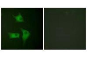 Immunofluorescence analysis of HeLa cells, using p15 INK antibody. (CDKN2B antibody)