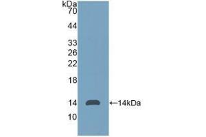 Detection of Recombinant Thy1, Human using Polyclonal Antibody to Cluster of Differentiation 90 (CD90) (CD90 antibody  (AA 20-133))