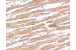 Immunohistochemistry of GPVI in human heart tissue with GPVI antibody at 10 μg/ml. (GP6 antibody  (C-Term))