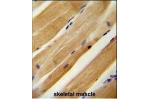 MLXIP antibody (N-term) (ABIN654186 and ABIN2844037) immunohistochemistry analysis in formalin fixed and paraffin embedded human skeletal muscle followed by peroxidase conjugation of the secondary antibody and DAB staining. (MLXIP antibody  (N-Term))