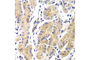 Immunohistochemistry of paraffin-embedded human gastric using HRAS antibody (ABIN5975854) at dilution of 1/100 (40x lens).