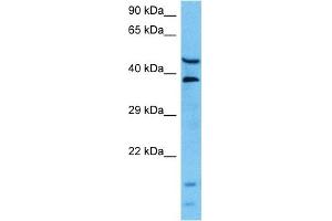 Host:  Mouse  Target Name:  L Sample Tissue:  Mouse Pancreas  Antibody Dilution:  1ug/ml (LARP6 antibody  (Middle Region))