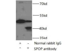 IP analysis of HeLa cell lysates (3000 μg), using SPOP antibody (1/500 dilution, 3 μg). (SPOP-B antibody)
