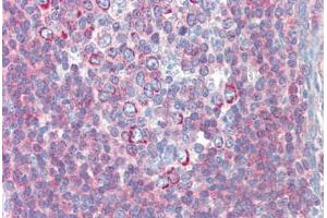 Immunohistochemistry (Paraffin-embedded Sections) (IHC (p)) image for anti-BTB and CNC Homology 1, Basic Leucine Zipper Transcription Factor 2 (BACH2) (C-Term) antibody (ABIN6741581)