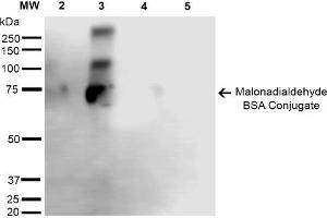 Western Blot analysis of Malondialdehyde-BSA Conjugate showing detection of 67 kDa Malondialdehyde -BSA using Mouse Anti-Malondialdehyde Monoclonal Antibody, Clone 6H6 . (Malondialdehyde antibody  (Biotin))