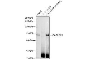 Immunoprecipitation analysis of 300 μg extracts of Jurkat cells using 3 μg GB antibody (ABIN6127943, ABIN6140978, ABIN6140979 and ABIN6225075). (GATAD2B antibody  (AA 1-120))
