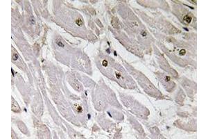 Immunohistochemistry analyzes of Pax-1 antibody in paraffin-embedded human heart tissue. (PAX1 antibody)
