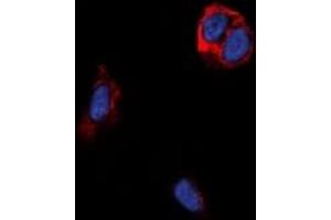 Immunofluorescent analysis of TRB1 staining in MCF7 cells. (TAS2R14 antibody)