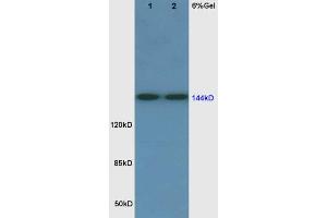 Rat lung lysates 30ug, probed  at 1:200 overnight in 4˚C. (FLT1 antibody  (AA 1162-1260))