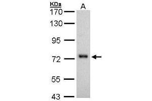 WB Image Sample (30 ug of whole cell lysate) A: H1299 7. (CD73 antibody)
