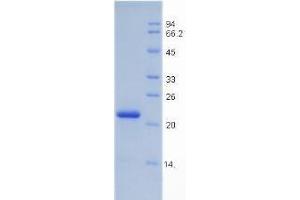 SDS-PAGE analysis of Rat Insulin Like Growth Factor Binding Protein 3 (IGFBP3) Protein. (IGFBP3 Protein)