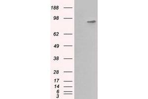 HEK293T cells were transfected with the pCMV6-ENTRY control (Left lane) or pCMV6-ENTRY BHMT (Right lane) cDNA for 48 hrs and lysed. (BHMT antibody)