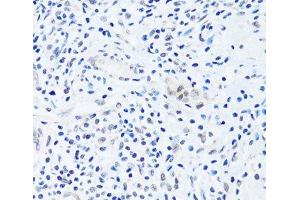 Immunohistochemistry of paraffin-embedded Human appendix using BRIX1 Polyclonal Antibody at dilution of 1:100 (40x lens).