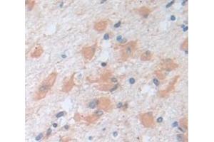 Figure. (NME1 antibody  (AA 1-152))