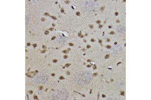 Immunohistochemistry of paraffin-embedded rat brain using MonoMethyl-Histone H3-K9 antibody (ABIN7267685) at dilution of 1:100 (40x lens). (Histone 3 antibody  (H3K9me))