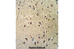 Immunohistochemistry (IHC) image for anti-Karyopherin (Importin) beta 1 (KPNB1) antibody (ABIN3002817) (KPNB1 antibody)