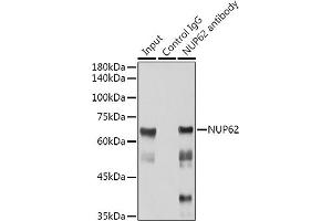 Immunoprecipitation analysis of 300 μg extracts of Jurkat cells using 3 μg NUP62 antibody (ABIN7269045). (NUP62 antibody)