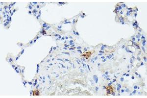 Immunohistochemistry of paraffin-embedded Rat lung using TIAL1 Polyclonal Antibody at dilution of 1:100 (40x lens). (TIAL1 antibody)