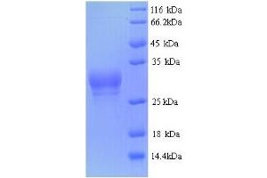 SDS-PAGE (SDS) image for Probable Serine/threonine-Protein Phosphatase 2A Regulatory Subunit B'' Subunit TON2 (FASS) (AA 1-28), (full length) protein (GST tag) (ABIN5714198)