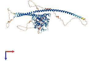 TLK2 Protein (AA 1-772) (His tag)