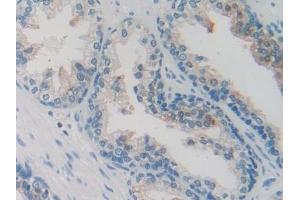Detection of SCGN in Human Prostate Tissue using Polyclonal Antibody to Secretagogin (SCGN) (SCGN antibody  (AA 1-276))