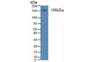 Figure. (Insulin Receptor antibody  (AA 1024-1298))
