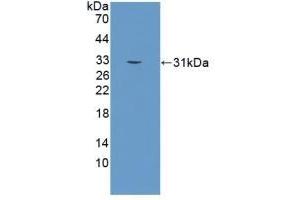 Detection of Recombinant KLK2, Human using Polyclonal Antibody to Kallikrein 2 (KLK2) (Kallikrein 2 antibody  (AA 19-261))