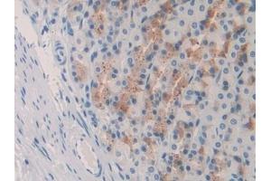 Detection of IL10 in Rat Stomach Tissue using Monoclonal Antibody to Interleukin 10 (IL10) (IL-10 antibody  (AA 19-178))