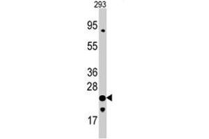 Western blot analysis of FXN polyclonal antibody  in 293 cell line lysates (35 ug/lane). (Frataxin antibody  (C-Term))
