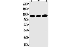 Anti-TRPV3 antibody, Western blotting Lane 1: HELA Cell Lysate Lane 2: A549 Cell Lysate Lane 3: MCF-7 Cell Lysate (TRPV3 antibody  (C-Term))