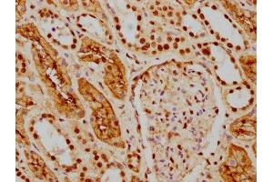 IHC image of ABIN7127541 diluted at 1:154 and staining in paraffin-embedded human kidney tissue performed on a Leica BondTM system. (Recombinant HDAC9 antibody)