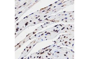 Immunohistochemistry of paraffin-embedded mouse heart using HMGB1 antibody (ABIN3059694) at dilution of 1/100 (40x lens). (HMGB1 antibody)