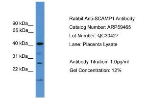 WB Suggested Anti-SCAMP1  Antibody Titration: 0. (SCAMP1 antibody  (Middle Region))