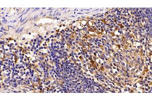 Detection of CTSS in Porcine Spleen Tissue using Polyclonal Antibody to Cathepsin S (CTSS) (Cathepsin S antibody  (AA 115-331))