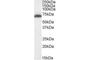 ABIN334405 (1µg/ml) staining of Mouse Brain lysate (35µg protein in RIPA buffer). (GAD antibody  (Internal Region))