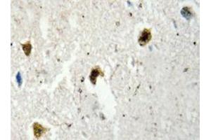 Immunohistochemistry analyzes of hnRNP H antibody in paraffin-embedded human brain tissue. (HNRNPH1 antibody)