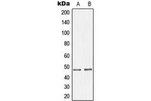 Western blot analysis of GHRH Receptor expression in SKNSH (A), LOVO (B) whole cell lysates. (GHRHR antibody  (C-Term))