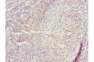 Immunohistochemistry of paraffin-embedded human tonsil tissue using ABIN7173433 at dilution of 1:100 (TRIM29 antibody  (AA 309-588))