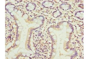 Immunohistochemistry of paraffin-embedded human small intestine tissue using ABIN7173079 at dilution of 1:100 (TMEM154 antibody  (AA 97-183))