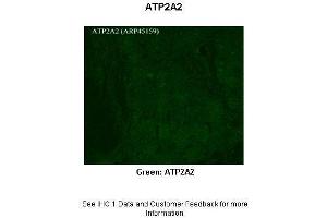 Sample Type :  Rhesus macaque spinal cord  Primary Antibody Dilution :  1:300  Secondary Antibody :  Donkey anti Rabbit 488  Secondary Antibody Dilution :  1:500  Color/Signal Descriptions :  Green: ATP2A2  Gene Name :  APLP2  Submitted by :  Timur Mavlyutov, Ph. (ATP2A2 antibody  (C-Term))