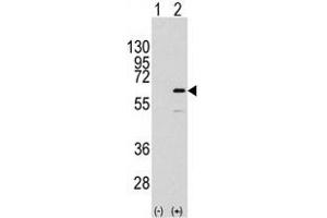 Western blot analysis of ELK1 (arrow) using rabbit polyclonal ELK1 Antibody  (R). (ELK1 antibody  (AA 361-390))