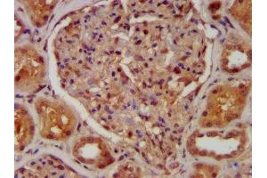 IHC image of ABIN7146380 diluted at 1:400 and staining in paraffin-embedded human kidney tissue performed on a Leica BondTM system. (CABP4 antibody  (AA 1-107))