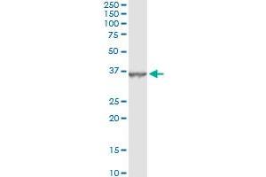 Immunoprecipitation of DHRS9 transfected lysate using anti-DHRS9 monoclonal antibody and Protein A Magnetic Bead , and immunoblotted with DHRS9 MaxPab rabbit polyclonal antibody. (DHRS9 antibody  (AA 1-319))