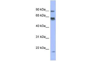 WB Suggested Anti-LRRFIP1 Antibody Titration:  0. (LRRFIP1 antibody  (N-Term))