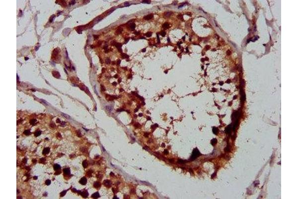 WHSC1 antibody  (AA 1-44)