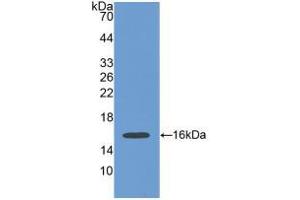 Western blot analysis of recombinant Human POSTN. (Periostin antibody  (AA 97-230))