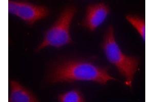 Immunofluorescence staining of methanol-fixed Hela cells using Phospho-MAPT-S262 antibody.