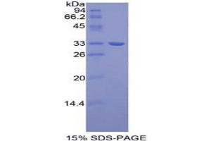 SDS-PAGE (SDS) image for Tubulin, beta 1 (TUBB1) (AA 182-437) protein (His tag) (ABIN1878178)